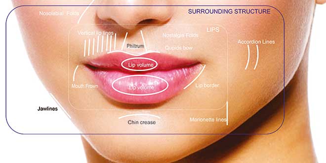 lip-augmentation.jpg