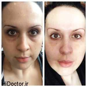 dottiebeforeandafter-300x300.png