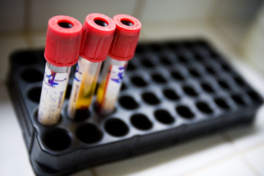 Blood-HIV-Cure-1024x683.jpg