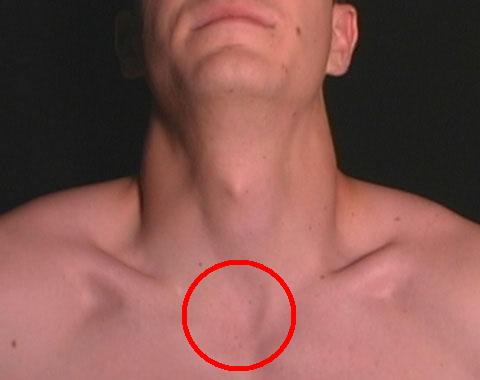 neck_triangles.jpeg